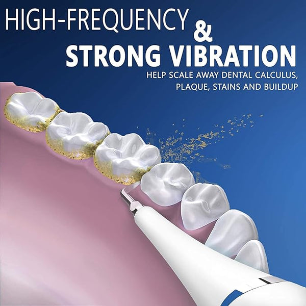 Denty™ - Elektrische tandenreiniger