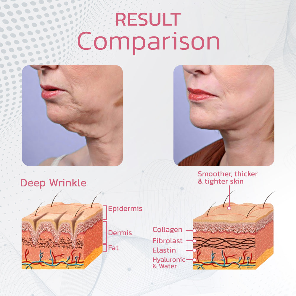 BeautyDevice™ - Reinig je lymfestelsel!