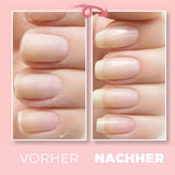 NailRepair™ - Laat je nagels weer stralen! | 1+1 GRATIS