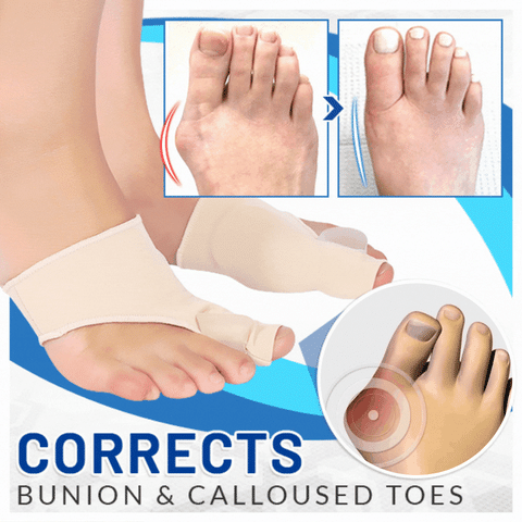 BunionCorrectorSleeve™ - Breng uw overlappende tenen effectief in lijn!